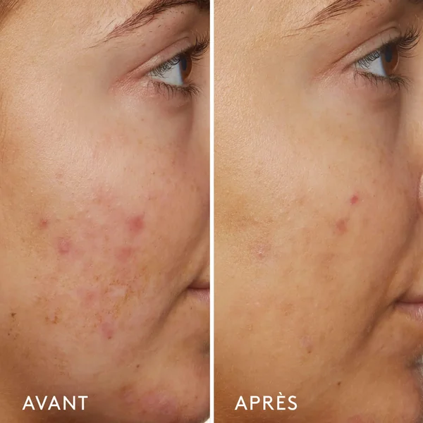 B3 Nice 10% Niacinamide Sérum Rééquilibrant