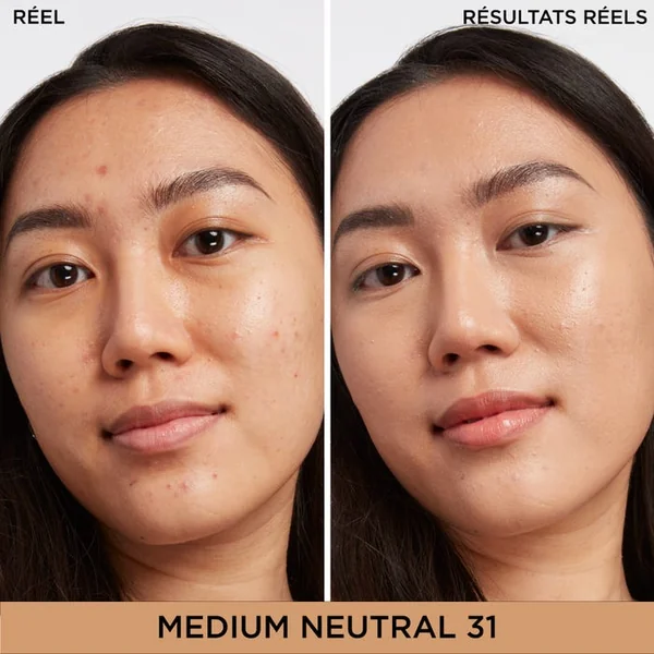 BYE BYE DARK SPOTS - Concealer Correcteur Teint + Sérum - Medium Neutral 31, 6.7ml
