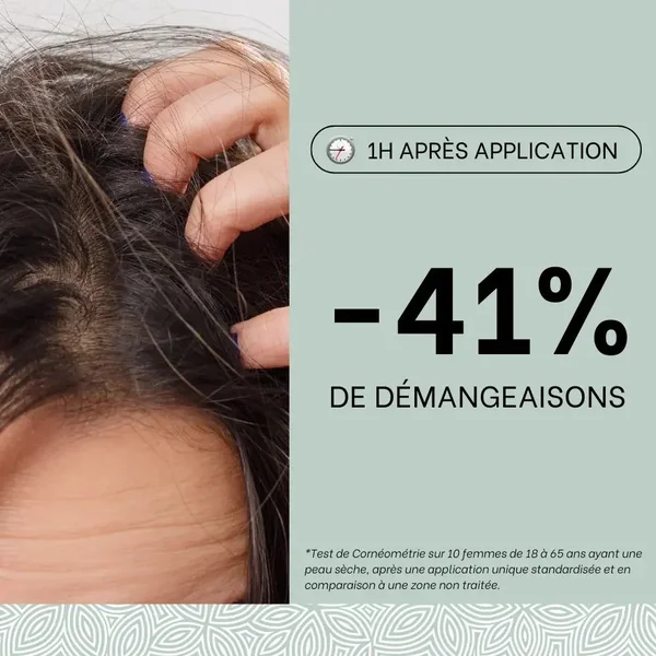 Cold cream SOS rougeurs, démangeaisons 150mL - Cuir chevelu
