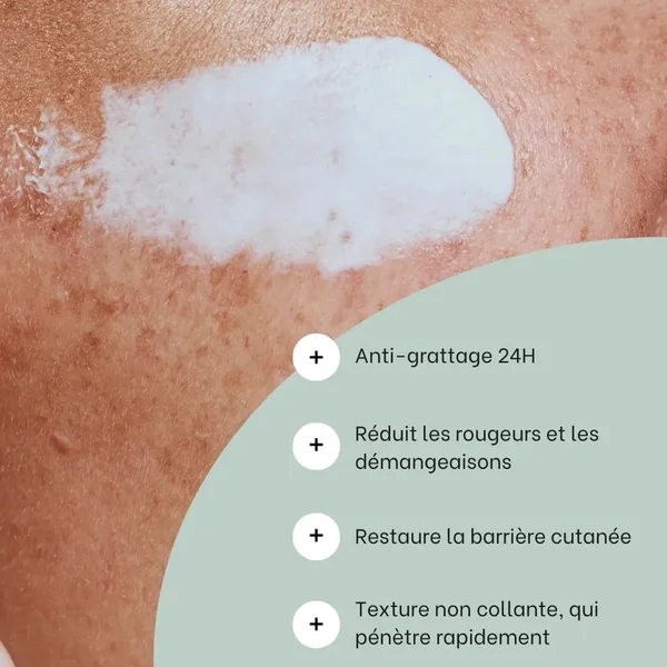 Cold Cream SOS rougeurs, démangeaisons - 150mL