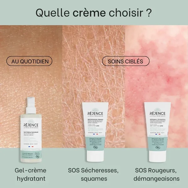 Cold Cream SOS rougeurs, démangeaisons - 150mL