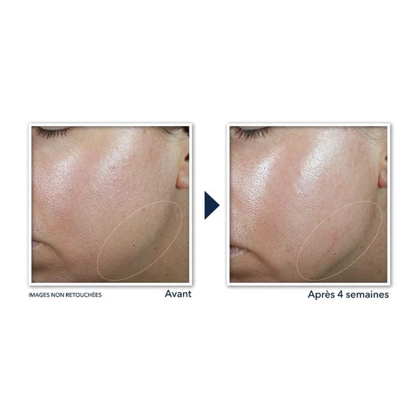 DERM CORREXION - Crème Contour - Visage et Cou - Tous Types de Peaux, 50ml