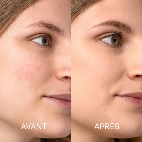 Duo SOS rougeurs SPF30