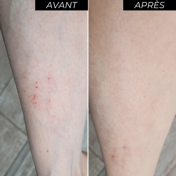 ENOCARE Crème Corps Hydratante