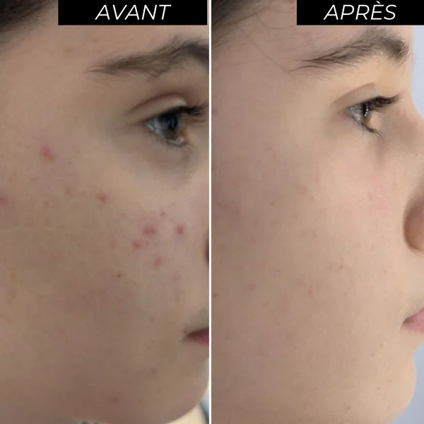 ENOLISS Coffret Peeling Eclat
