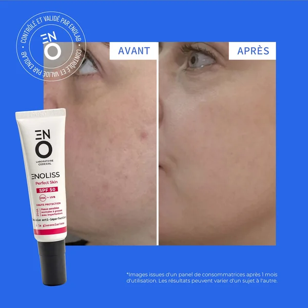 ENOLISS SPF 50