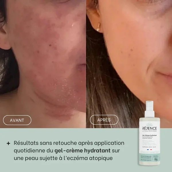 Gel-crème hydratant - 300mL