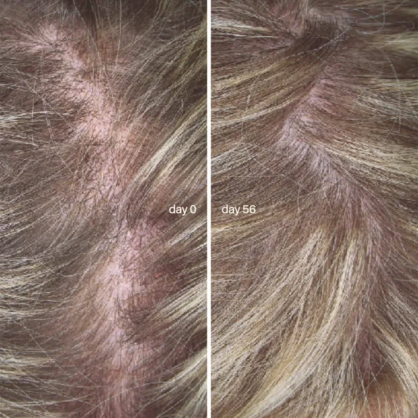 L'Essentiel Cheveux Cure de 3 mois