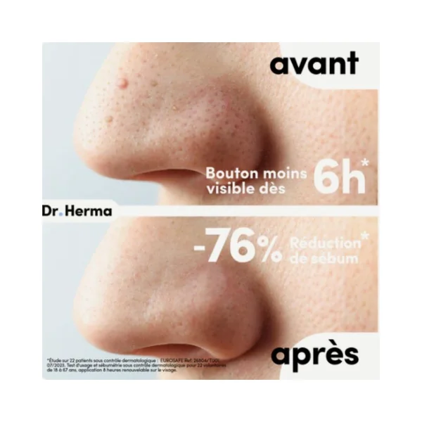 Patch anti-boutons Dr. Herma Format Nez x10