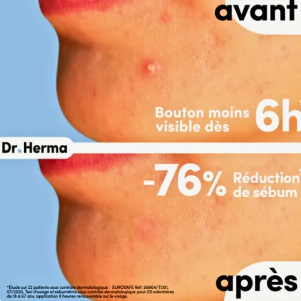 Patch anti-boutons Dr. Herma Format Petit x24