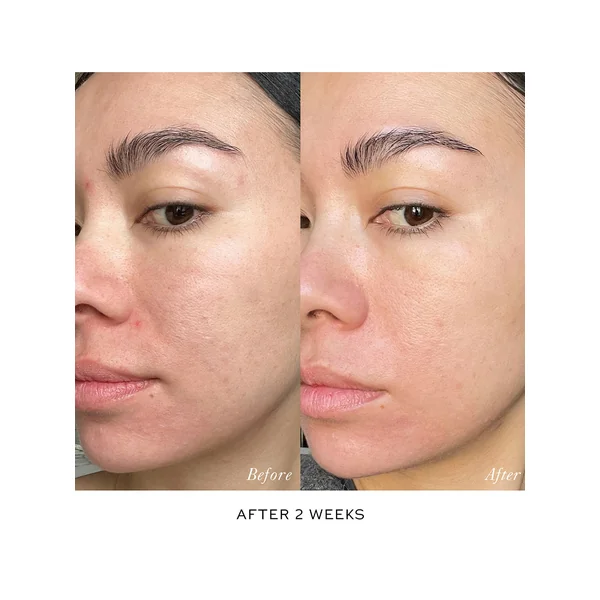 Skin Activator Serum Refill