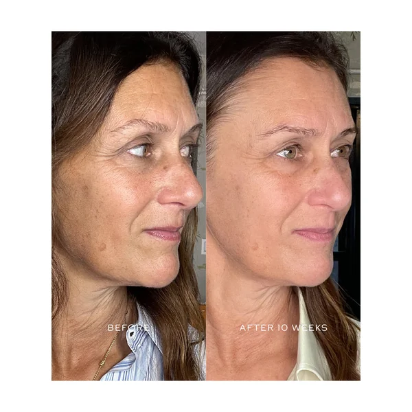 Suprême C Serum Refill