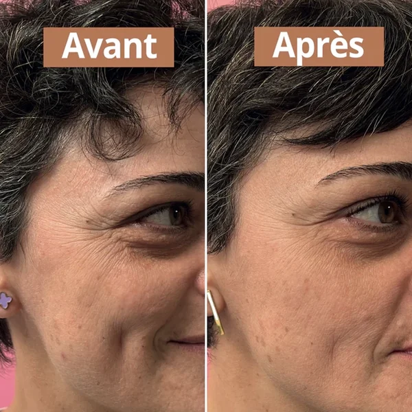 Sérum anti-âge