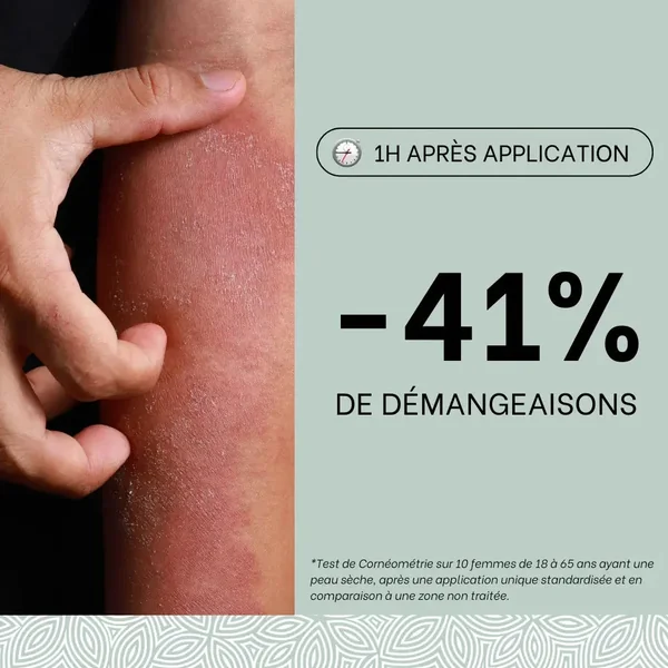 Trio crèmes eczéma